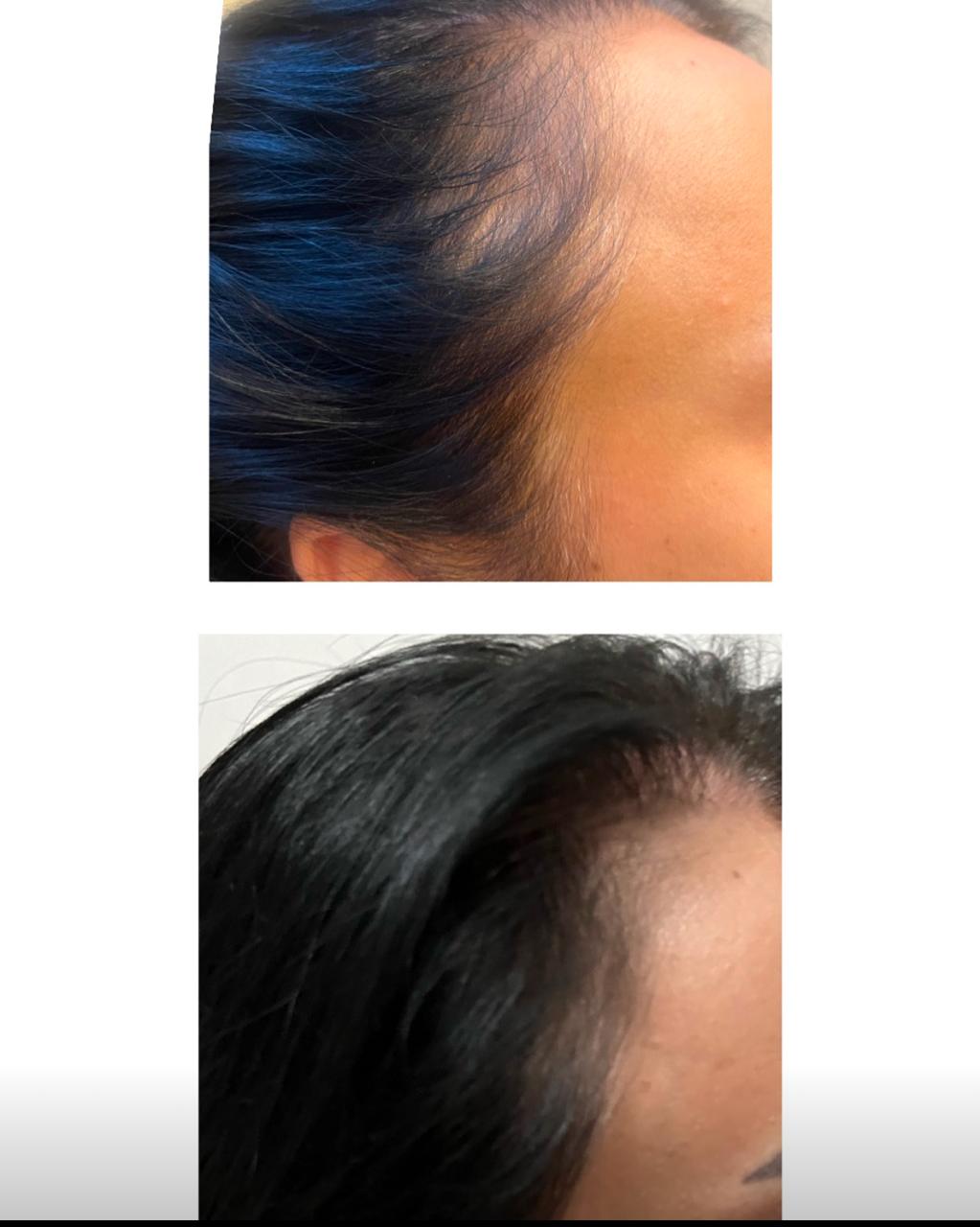 Antes e depois — tratamento capilar