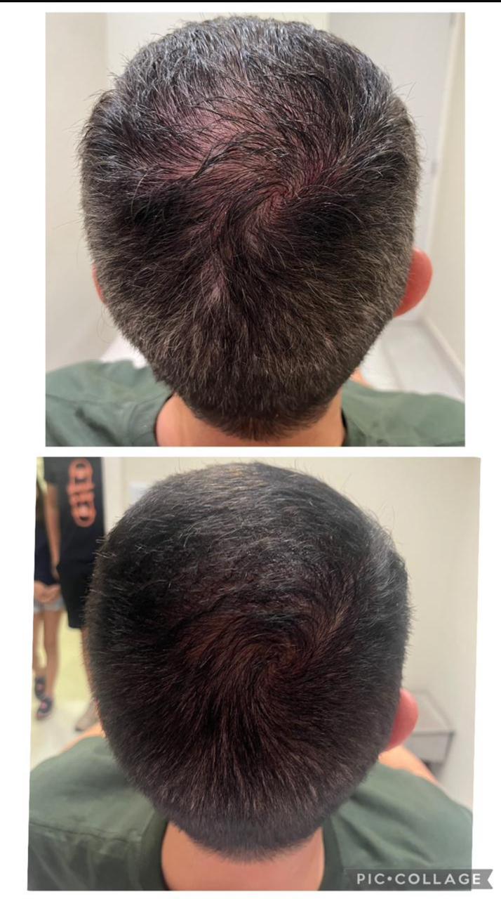 Antes e depois — tratamento capilar